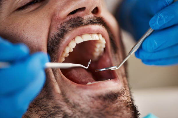 Best Emergency Treatment for Oral Infections in Woodmont, CT